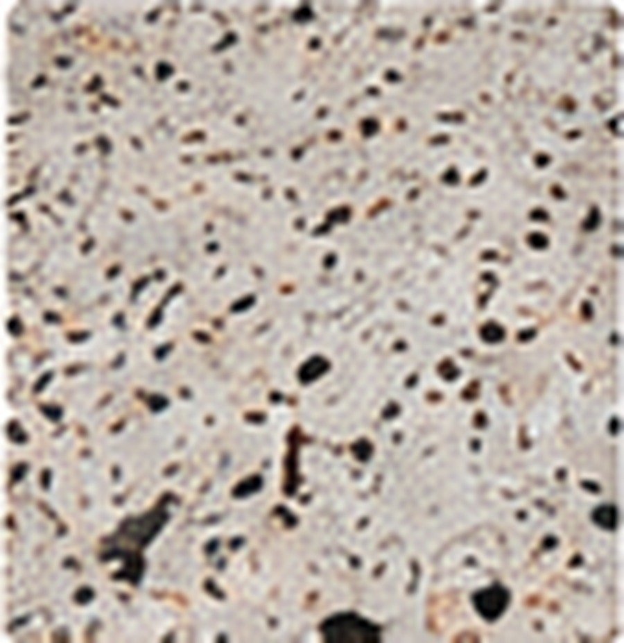 Terrazzo flooring